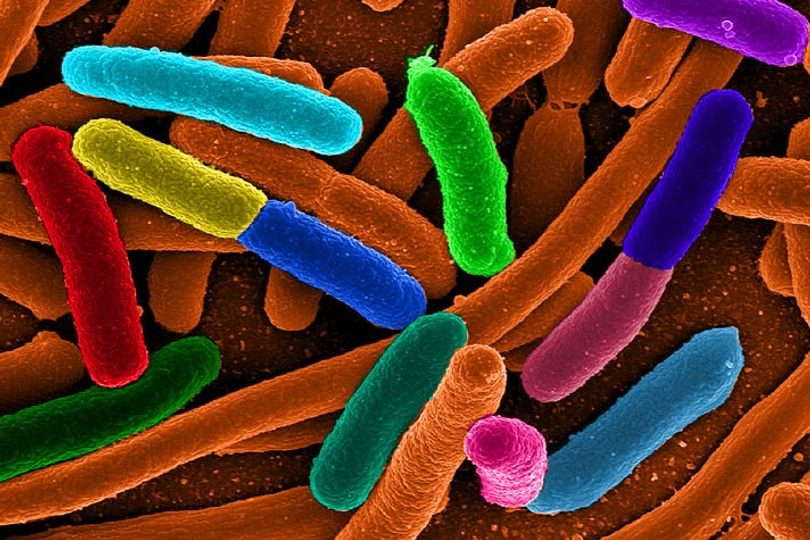 Diverse e Coli