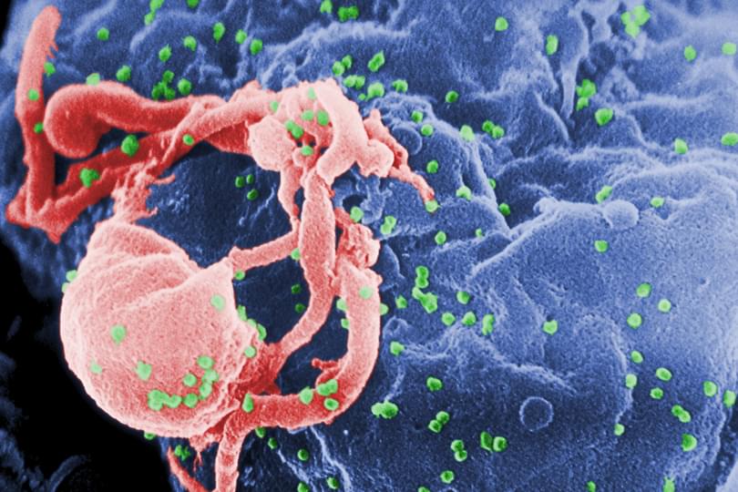 UK-HIV