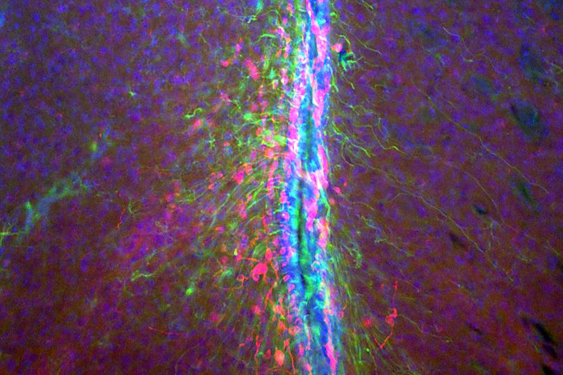 Stemcells adult